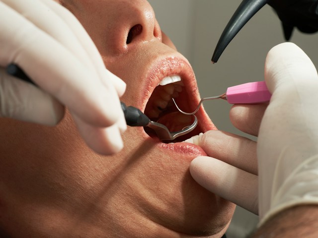 tindakan di klinik dokter gigi bandung